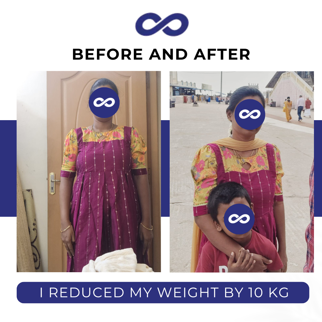Before and After 1