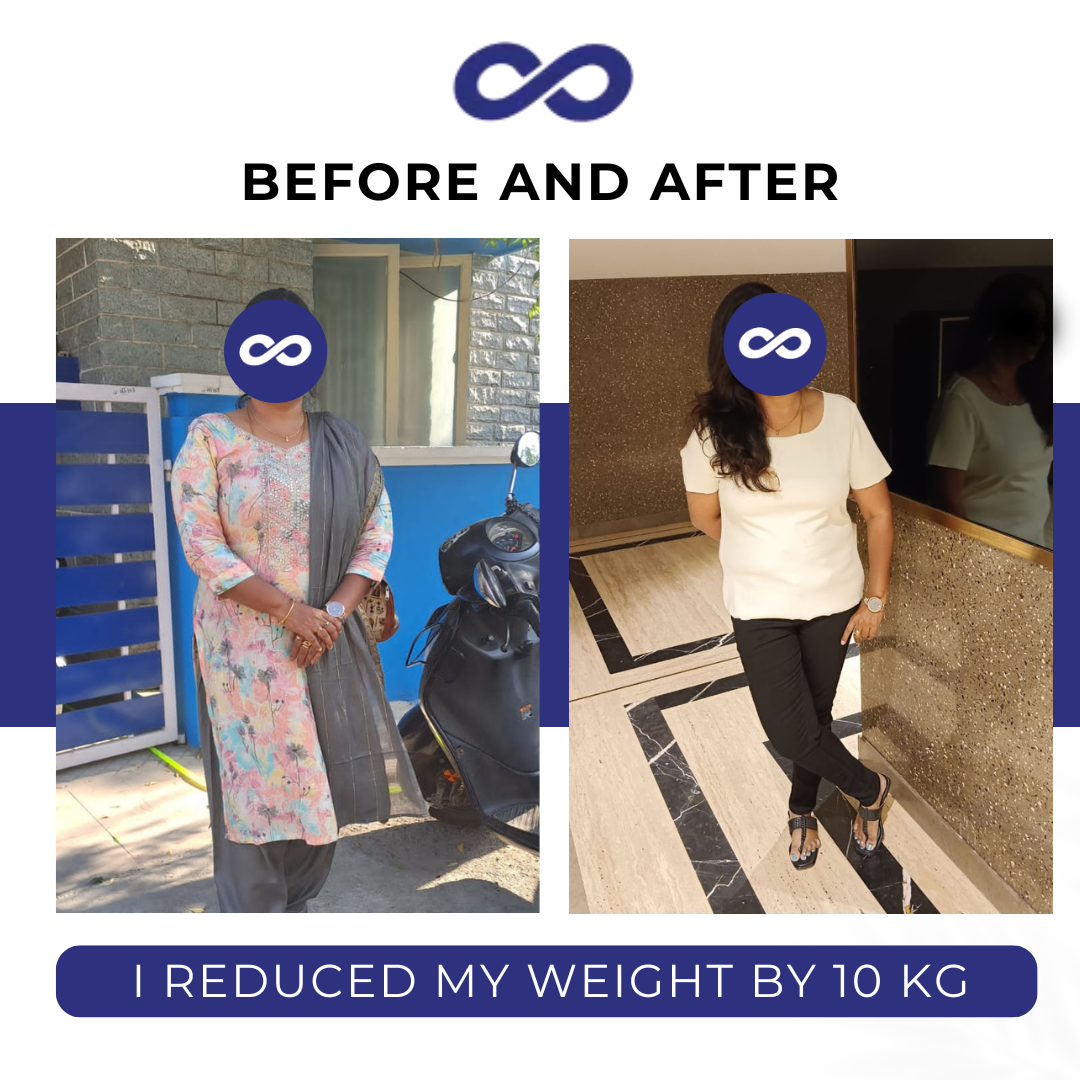 Before and After 2