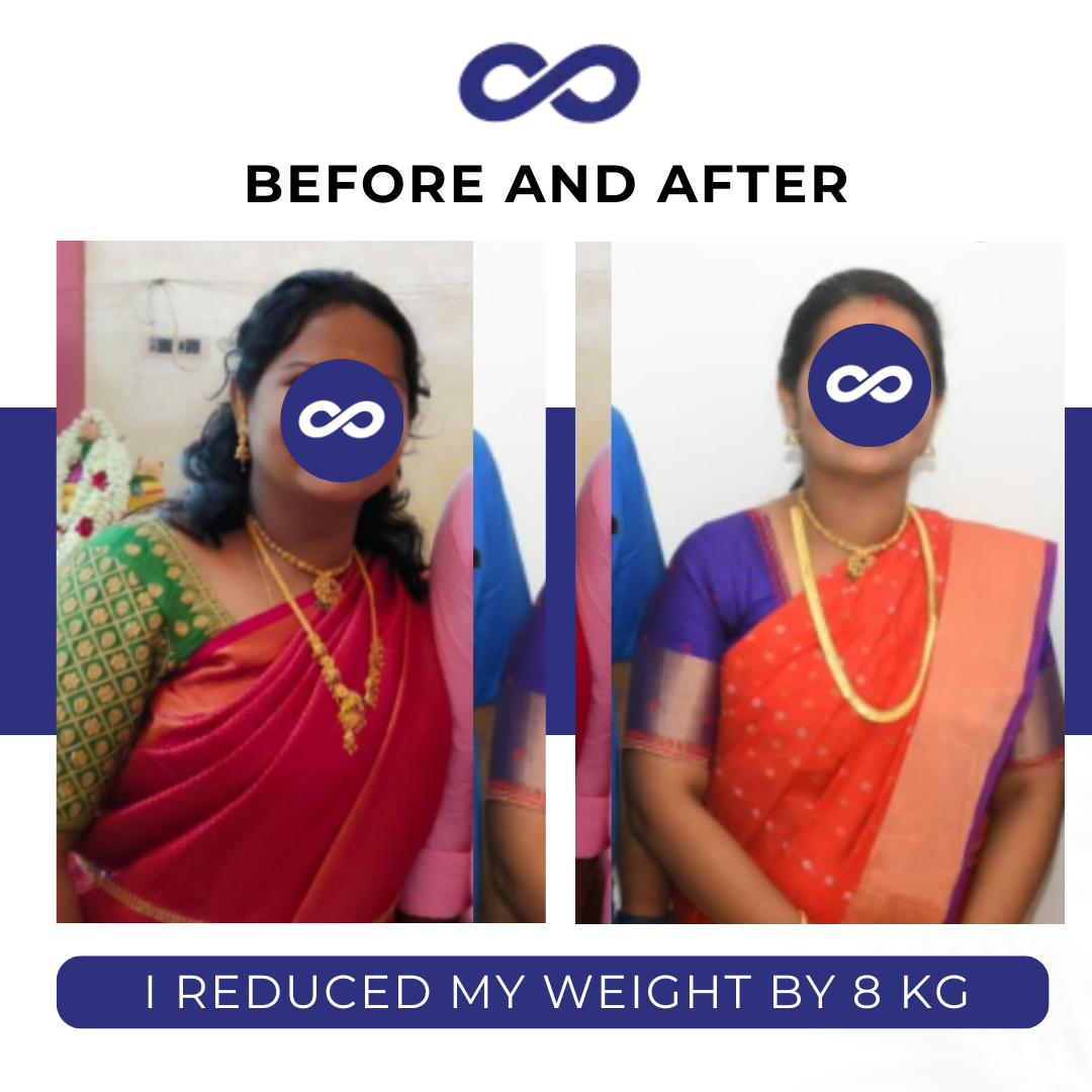 Before and After 3