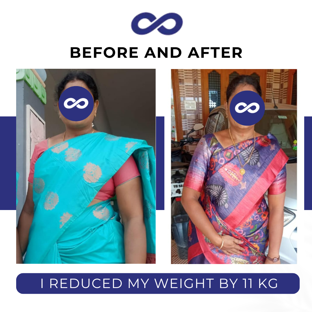 Before and After 4